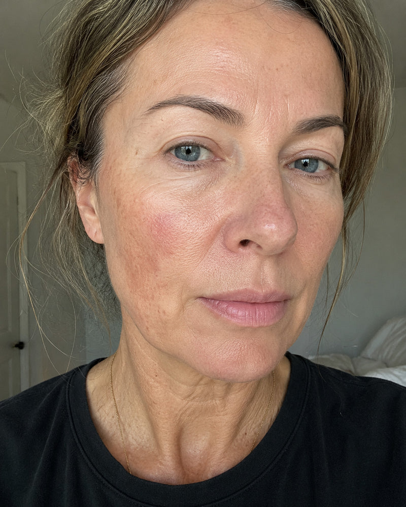 Woman noticing changing skin