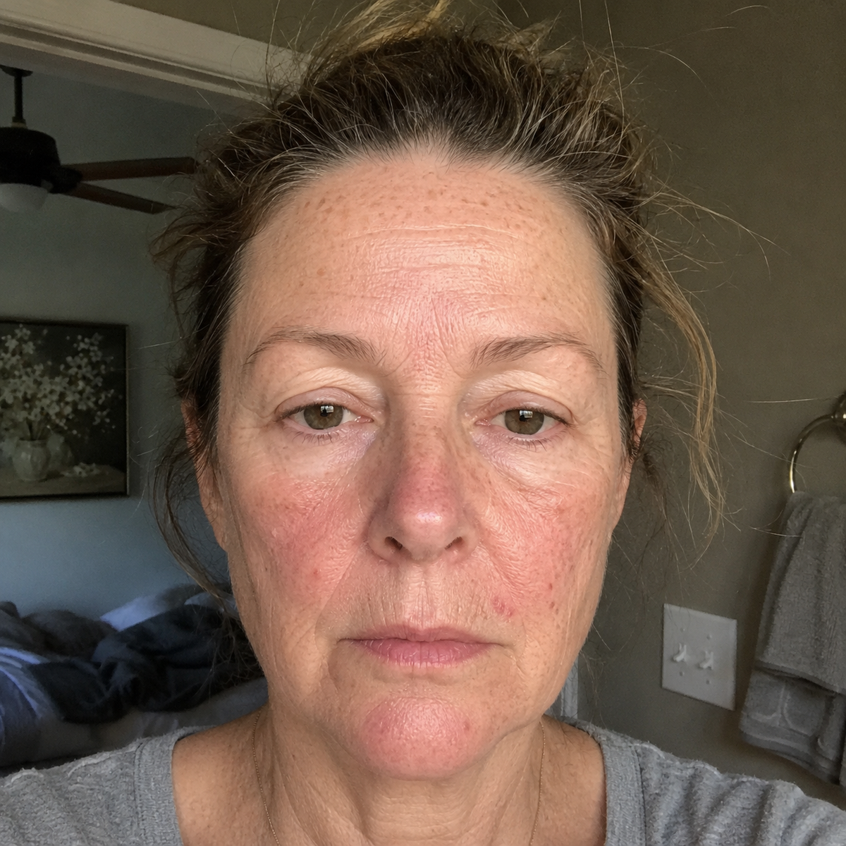 Day 0