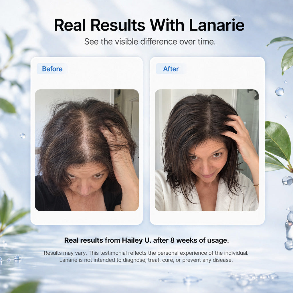 Lanarie Micro-Infusion Kit