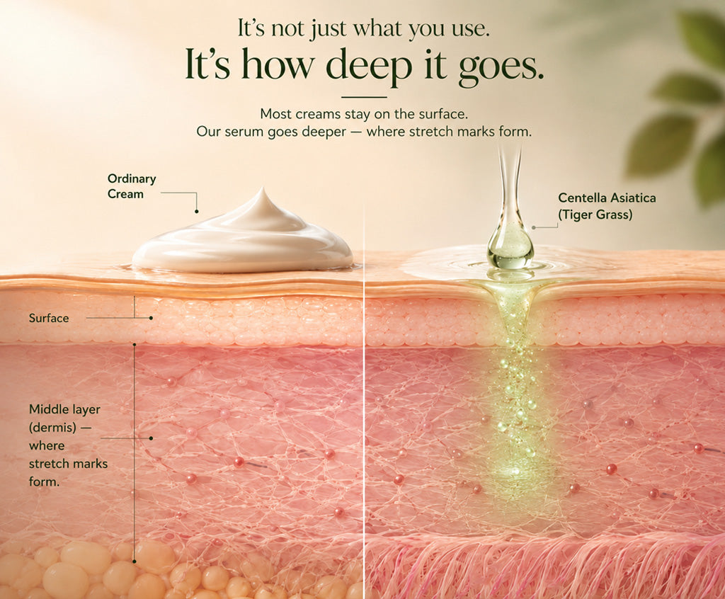 Most belly creams were never built to reach the layer where stretch marks actually form.